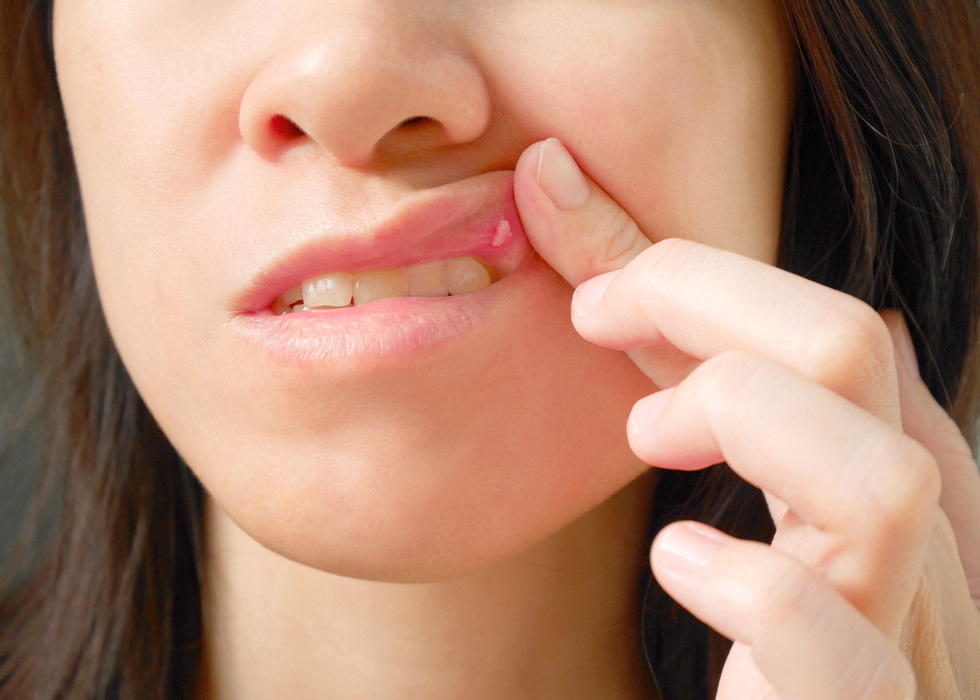 Mond- en lipaandoeningen