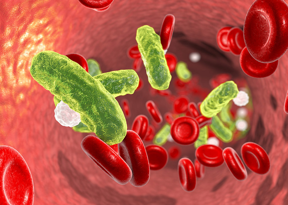 Infectie in de bloedbaan
