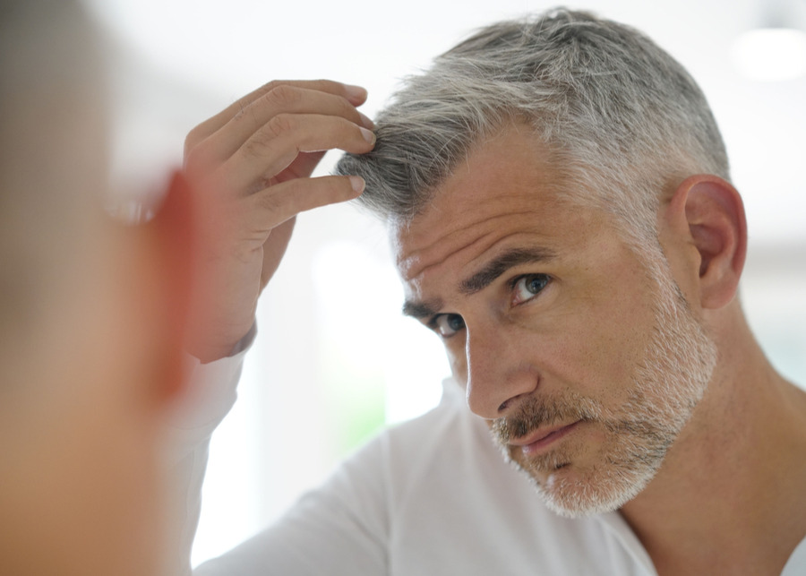 Waarom Zijn Mannen Gevoeliger Aan Haarverlies Dan Vrouwen Pazzox