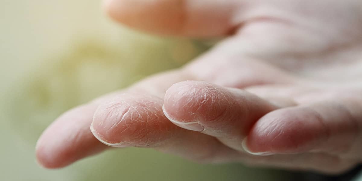 Compeed Gerçures et crevasses extrémités des doigts p.à 10 6x1cm, Protection de la peau, Dermatologie