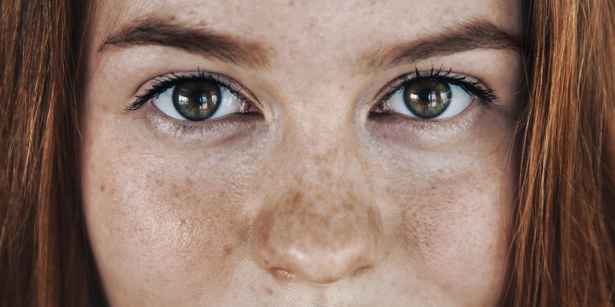 Protégez votre peau contre la pigmentation