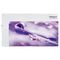 Lofric Sense Sonde Femme Nel. Ch12 15cm 30 4161265