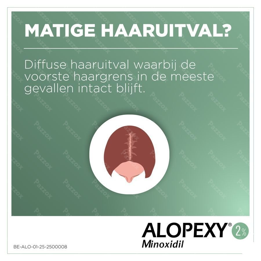 Alopexy 2% 3 x 60ml