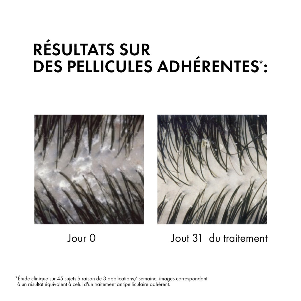 Vichy Dercos A/pell Chev. Sec Reno Sh 200ml