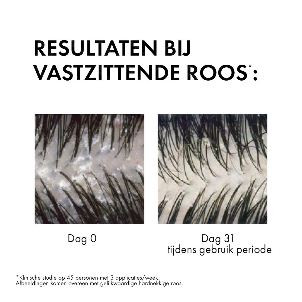 Vichy Dercos Anti-Roos Shampoo Normaal Tot Vet Haar 390ml