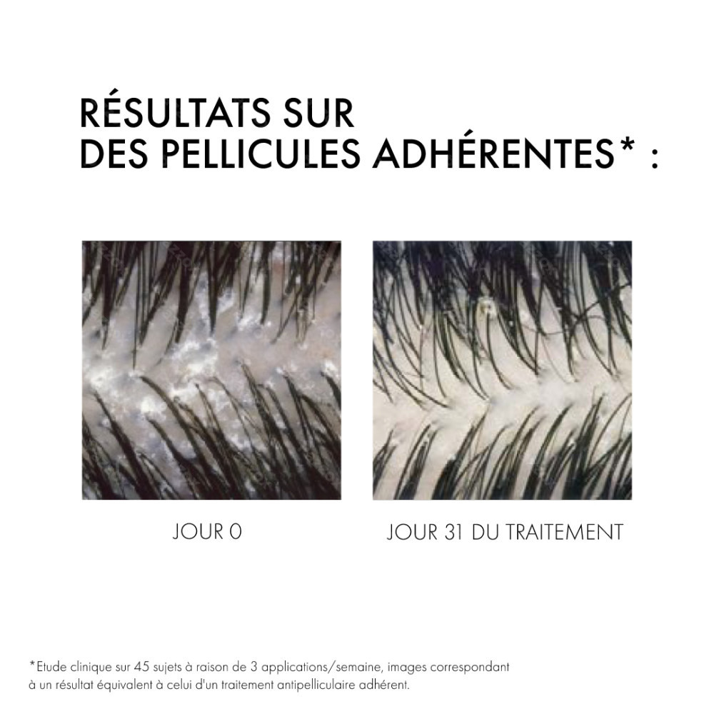 Vichy Dercos Anti-Pelliculaire Cheveux Secs 390ml