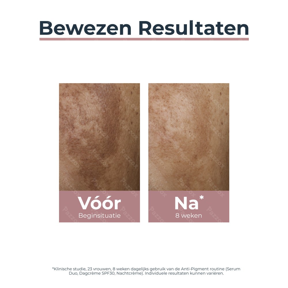 Eucerin Anti-Pigment Serum Duo Hyperpigmentatie 30ml