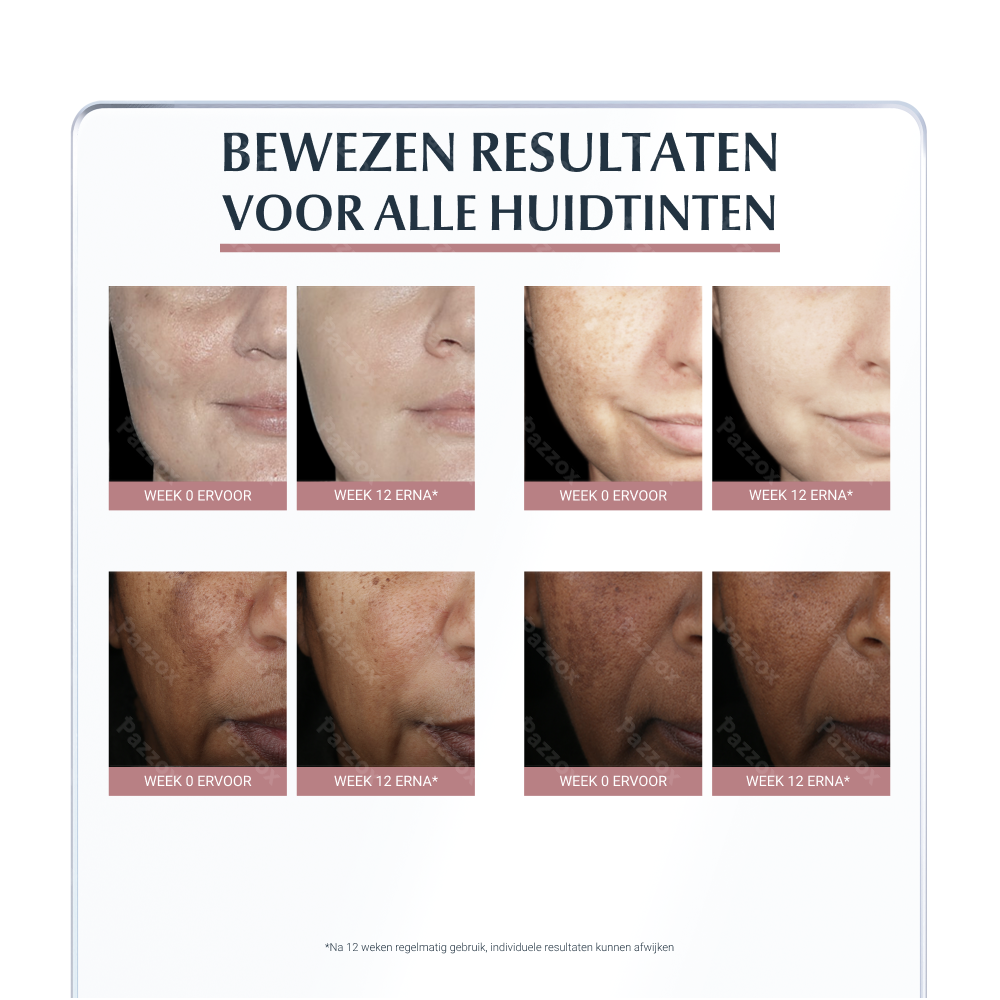 Eucerin Anti-Pigment Spot Corrector Lokale Applicatie Hyperpigmentatie 5ml
