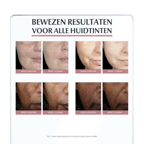 Eucerin Anti Pigment Dagcreme Hyperpigmentatie Spf30 50ml
