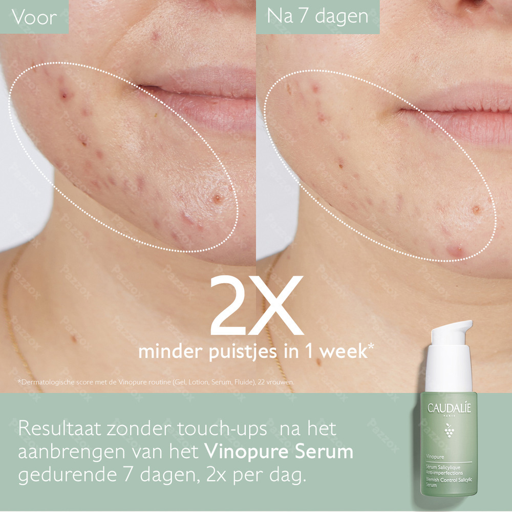 Caudalie Vinopure Serum Tegen Onzuiverheden 30ml