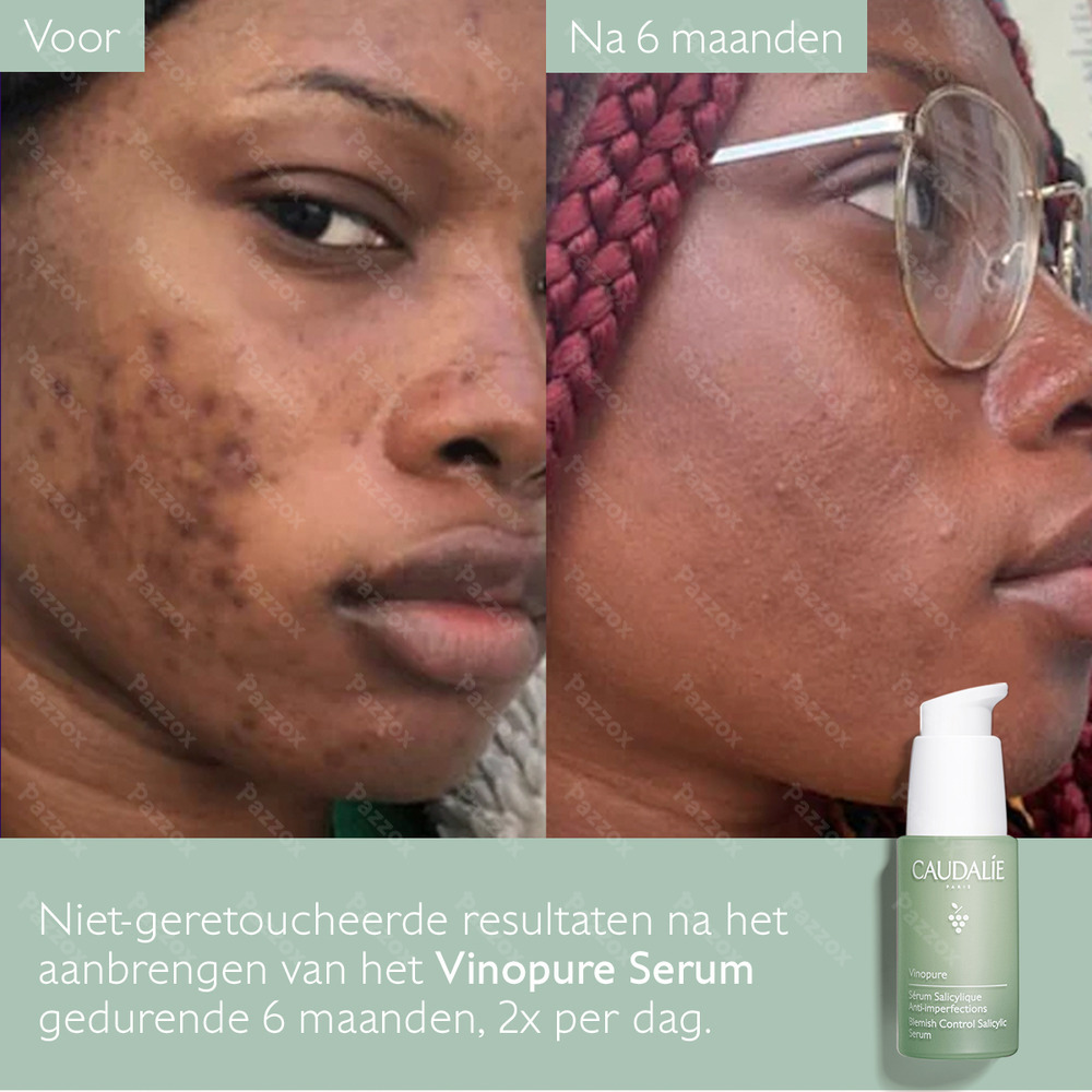 Caudalie Vinopure Serum Tegen Onzuiverheden 30ml