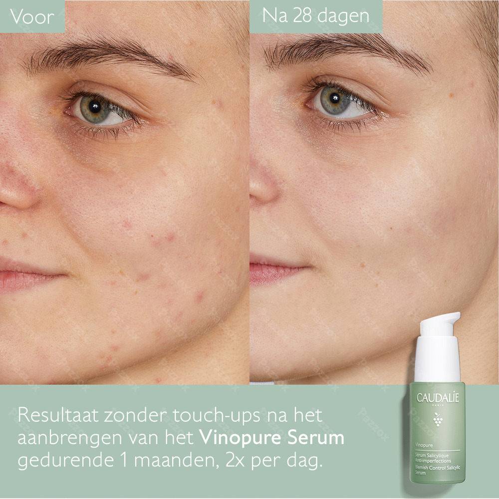 Caudalie Vinopure Serum Tegen Onzuiverheden 30ml