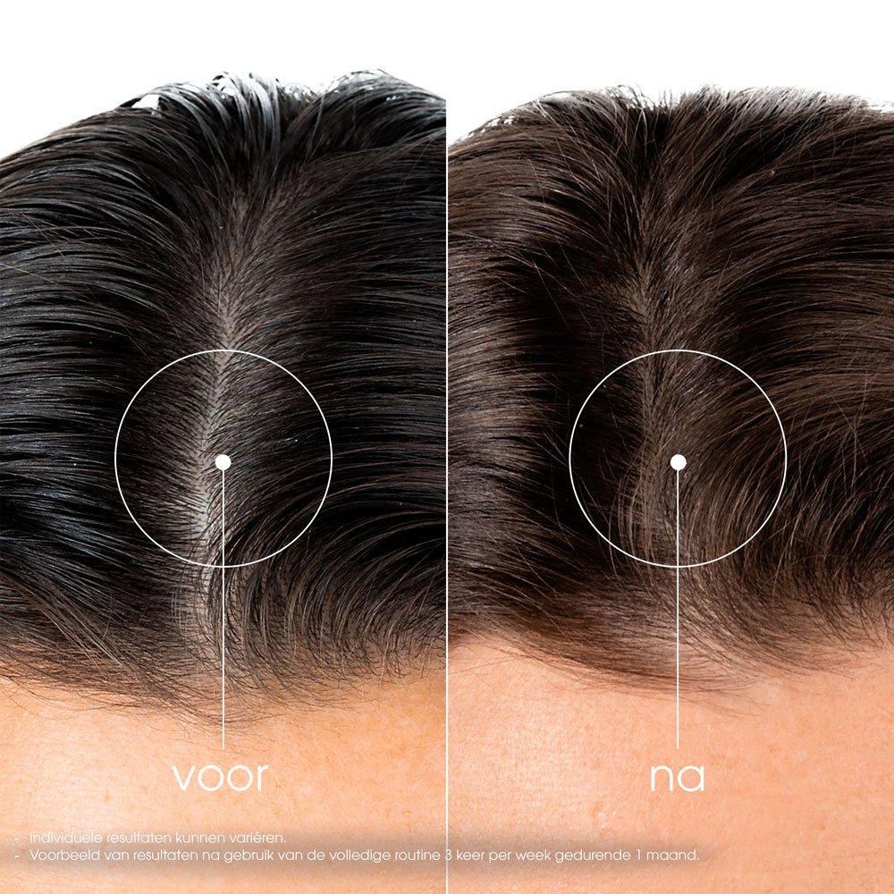 Klorane Capillaire Karatincaps Kracht en Vitaliteit 3x30 Capsules