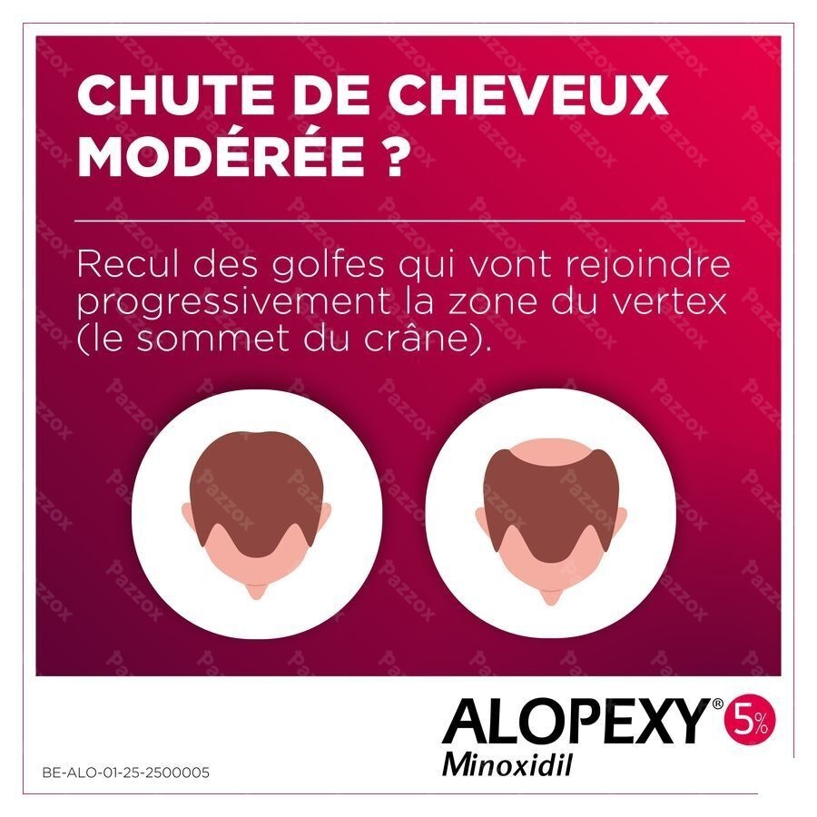 Alopexy 50mg/ml 3x60ml