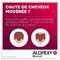 Alopexy 50mg/ml 60ml