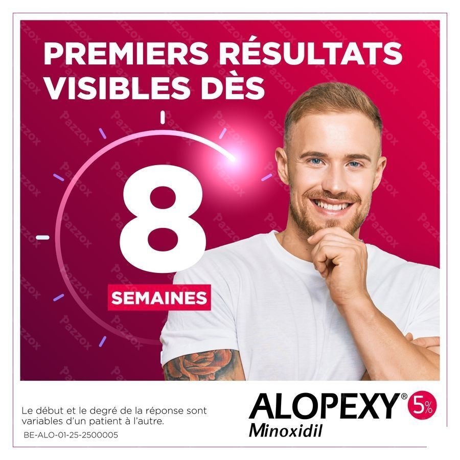 Alopexy 50mg/ml 60ml
