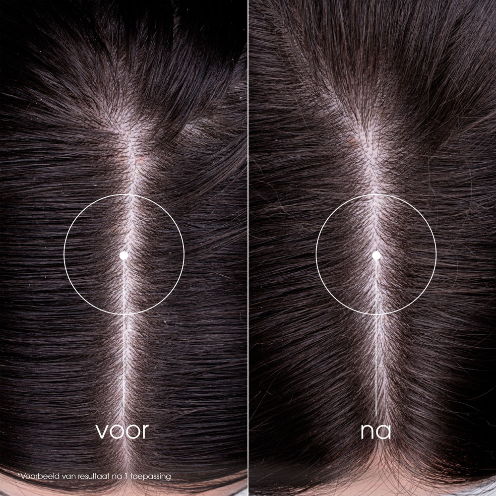 Klorane Capil. Sh Brandnetel 400ml Nf