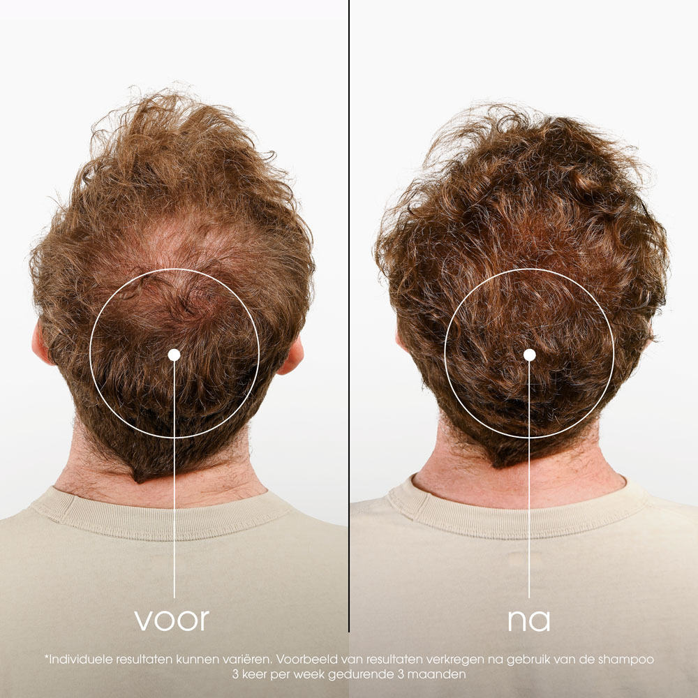 Klorane Capil. Sh Kinine 100ml