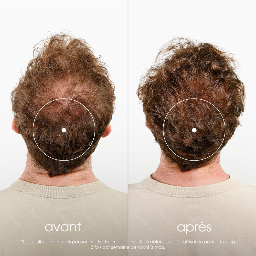 Klorane Shampooing Quinine & Edelweiss 400ml