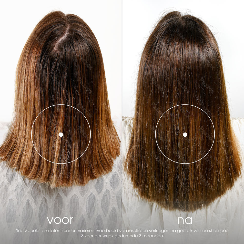 Klorane Shampoo Kinine & Edelweiss 400ml