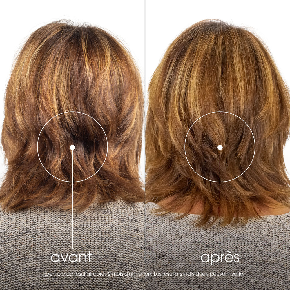 Klorane Capil. Sh Grenade 400ml