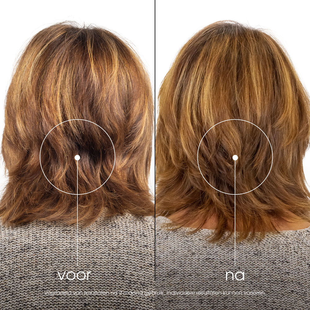 Klorane Capil. Balsem Grenaatappel 200ml