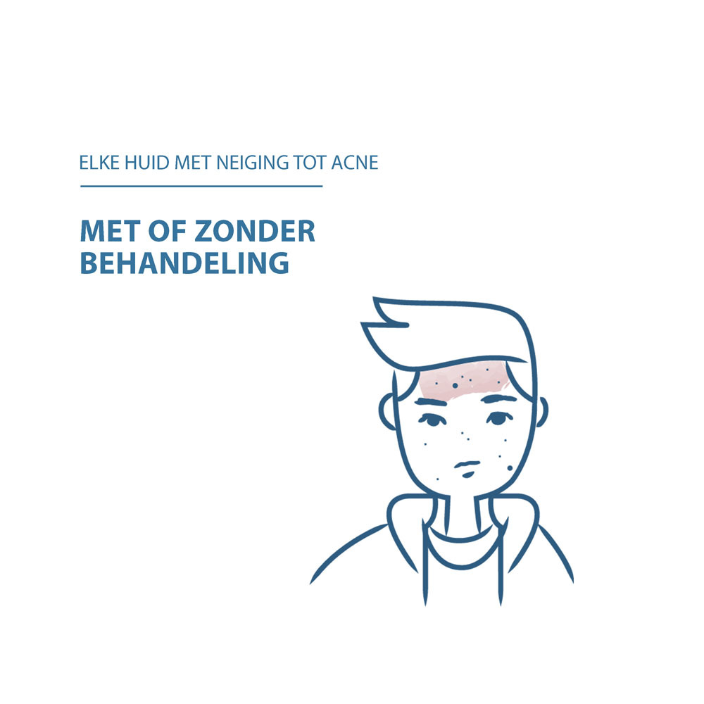 Ducray Keracnyl Schuimende Reinigingsgel 200ml