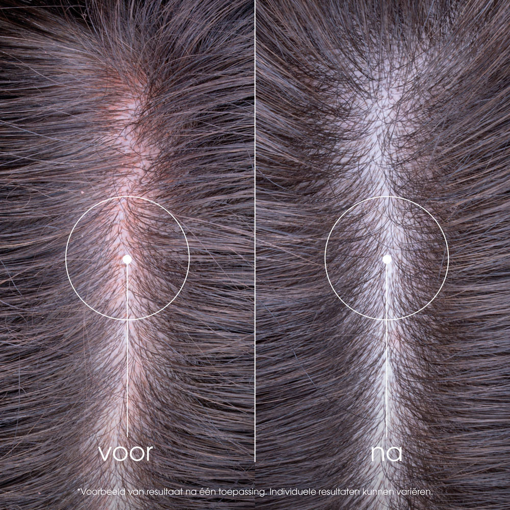 Klorane Capillaire Shampoo Pioenroos Bio 400ml