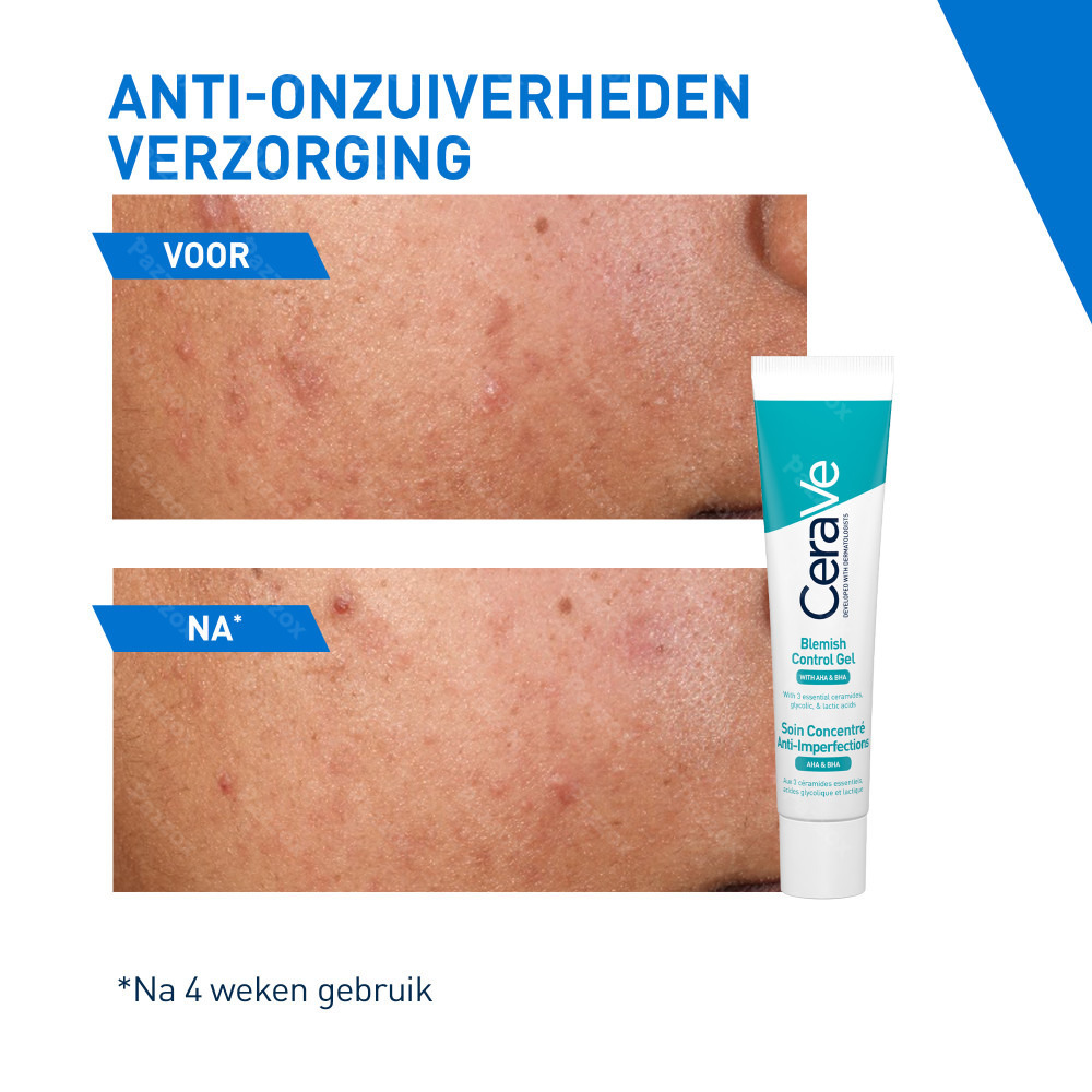 CeraVe Geconcentreerde Anti-Onzuiverheden Verzorging 40ml