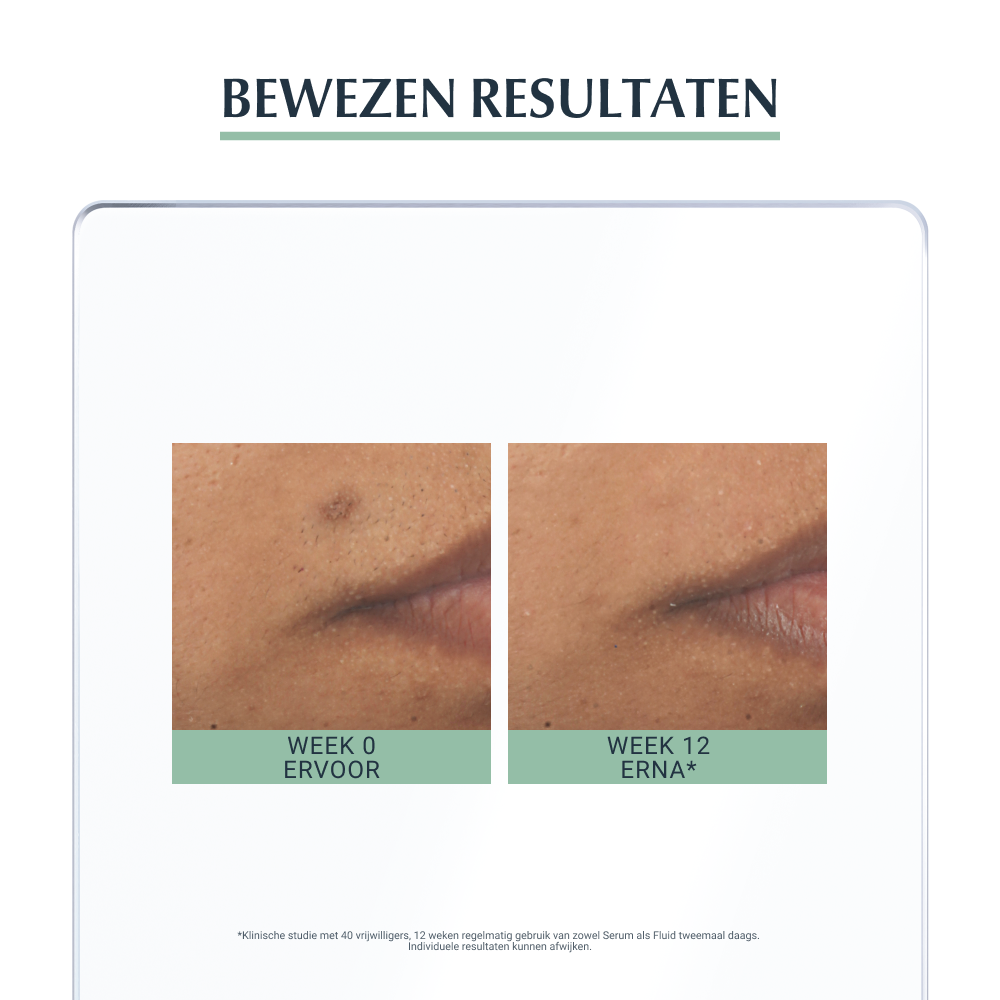 Eucerin Dermopure Triple Action Serum Post-Acne Vlekken Onzuivere Huid 40ml