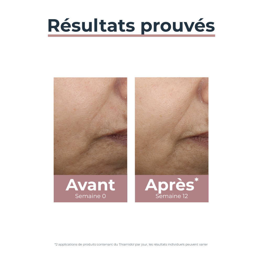 Eucerin Anti-Pigment Soin de Jour Teinté Light SPF30 Hyperpigmentation 50ml