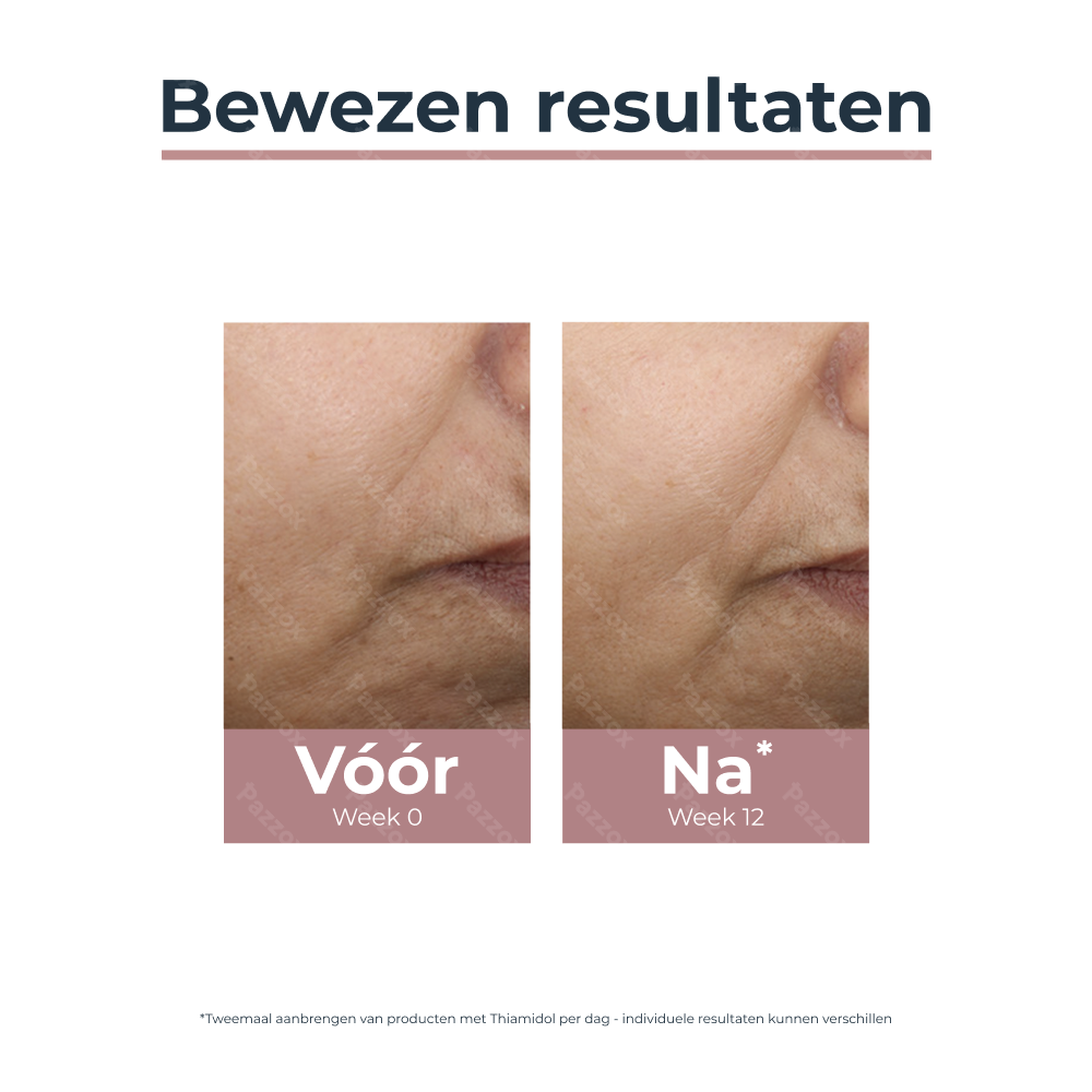 Eucerin Anti-Pigment Dagcrème SPF30 Getint Medium Hyperpigmentatie 50ml