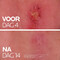 La Roche-Posay Cicaplast Balsem B5+ 100ml