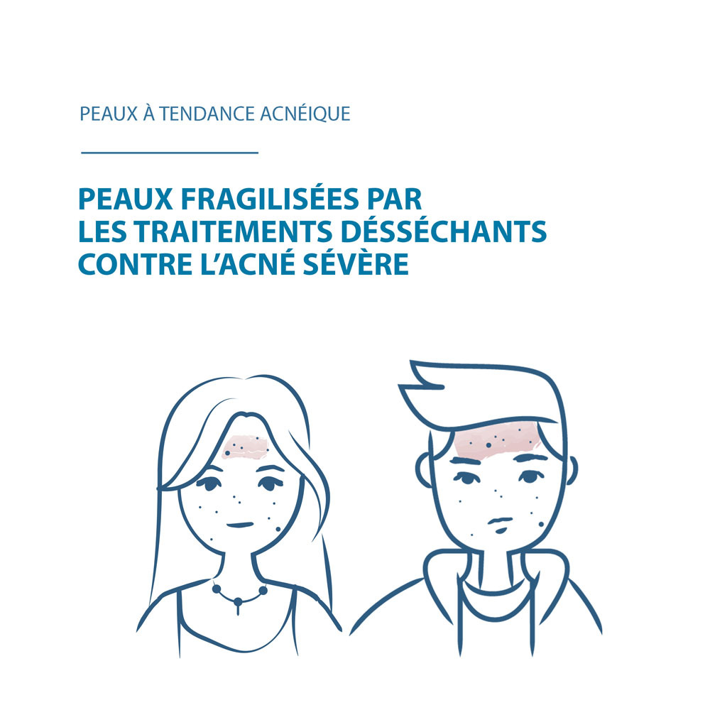 Ducray Keracnyl Repair Crème 50ml