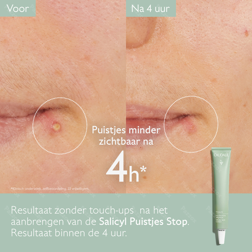 Caudalie Vinopure Salicylzuur Spot Treatment 15ml
