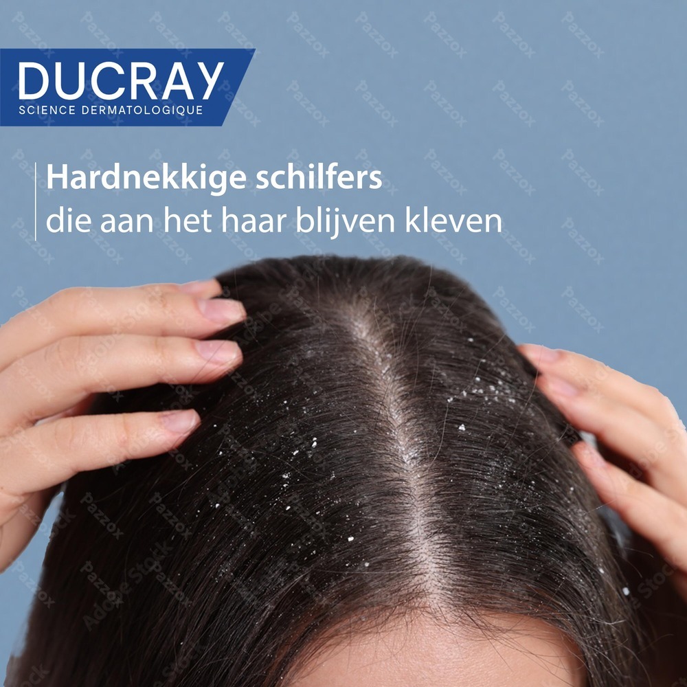 Ducray Kelual Squanorm Shampoo Vette Schilfers 200ml