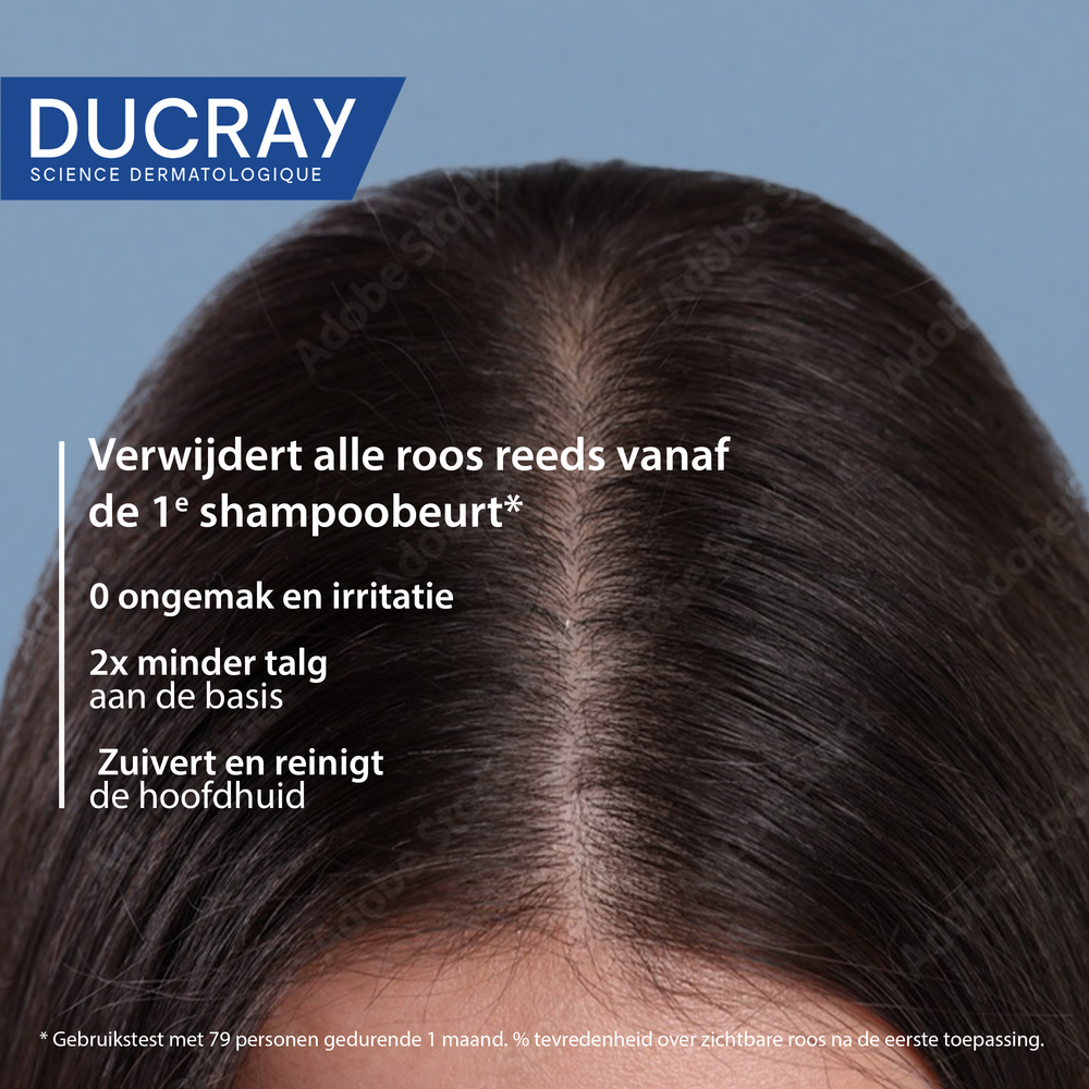 Ducray Kelual Squanorm Shampoo Vette schilfers 400ml