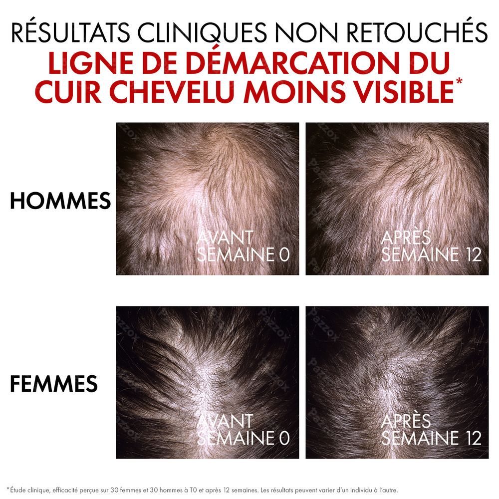 Vichy Dercos Aminexil Clinical R.E.G.E.N. BOOSTER 90ml