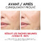 Vichy Liftactiv Specialist B3 Sérum Anti-Taches 30ml