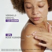 Aderma Epitheliale Creme SPF50+ Anti-vlekken 100ml