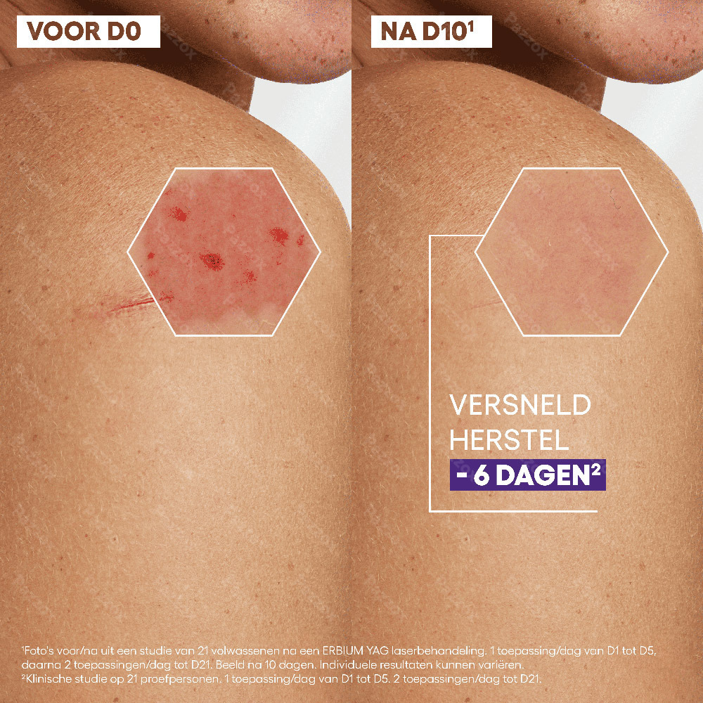 Aderma Epitheliale Ultra Repair Herstellende Crème tegen vlekken 40ml