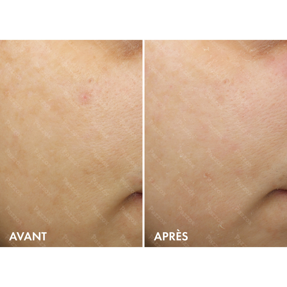 Vichy Liftactiv Pigment Specialist B3 Crème de Nuit 50ml