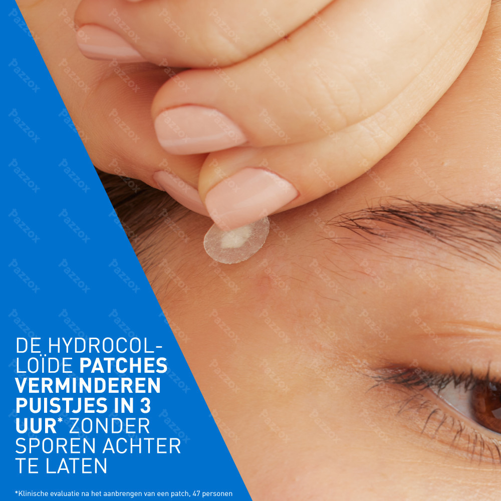 CeraVe Anti-Puistjes 22 Patches