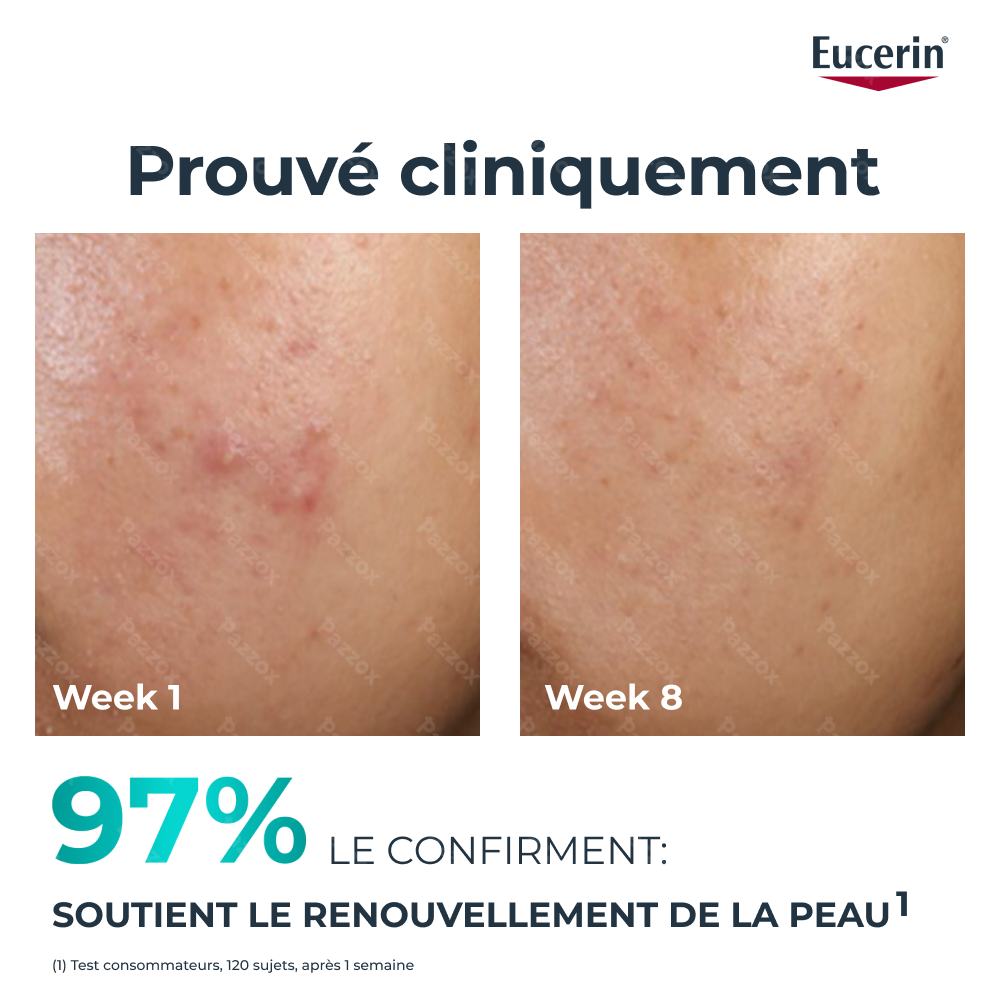 Eucerin Dermopure Clinical Peeling 10 Nachtverzorging 40ml