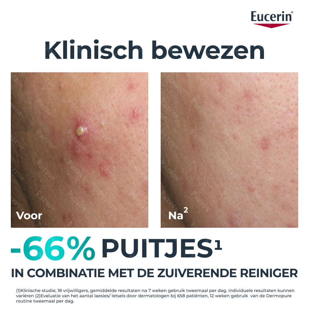 Eucerin Dermopure Clinical Triple Action Fluide 40ml