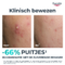 Eucerin Dermopure Clinical Triple Action Fluide 40ml