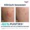 Eucerin Dermopure Clinical Triple Action Fluide 40ml
