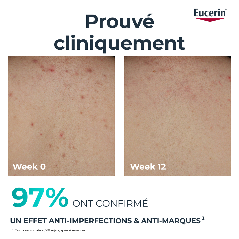 Eucerin Dermopure Clinical Crème Corps Correctrice 200ml