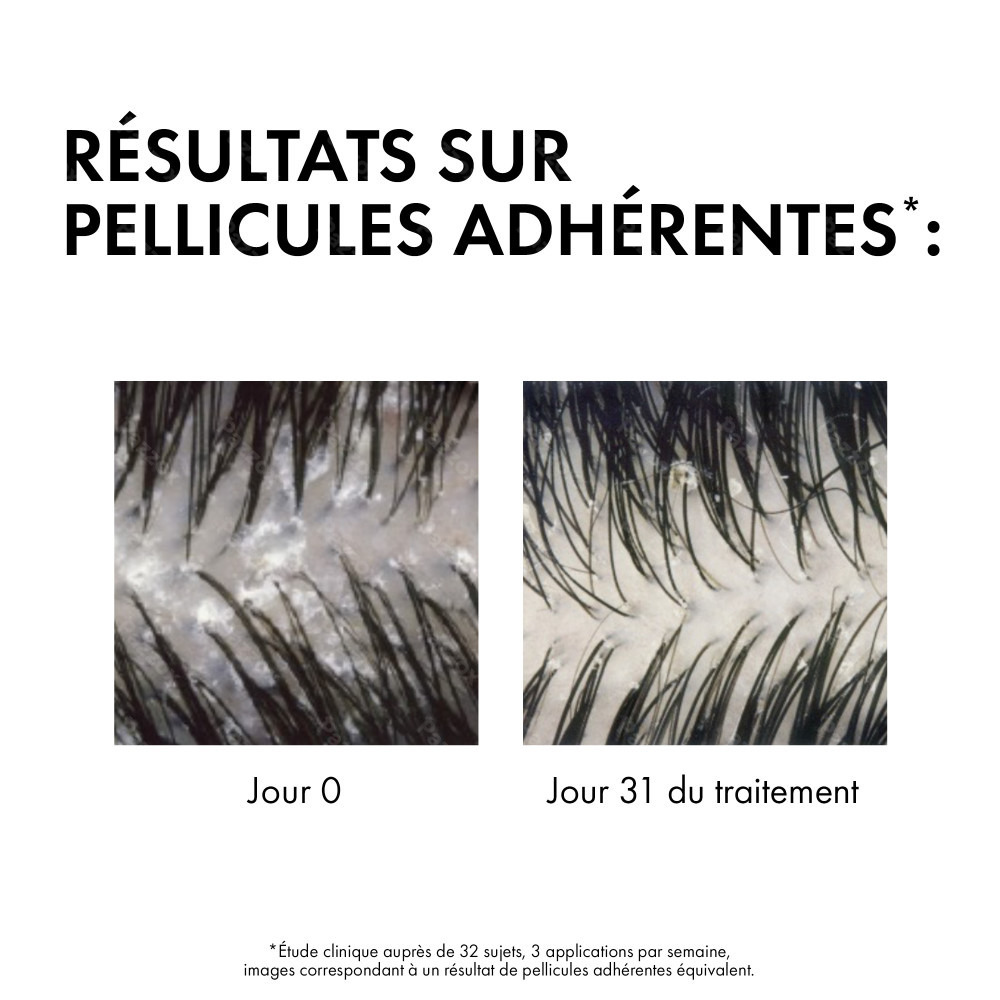 Vichy Dercos Shampooing Anti-Pelliculaire DS Recharge Cheveux Normaux à Gras