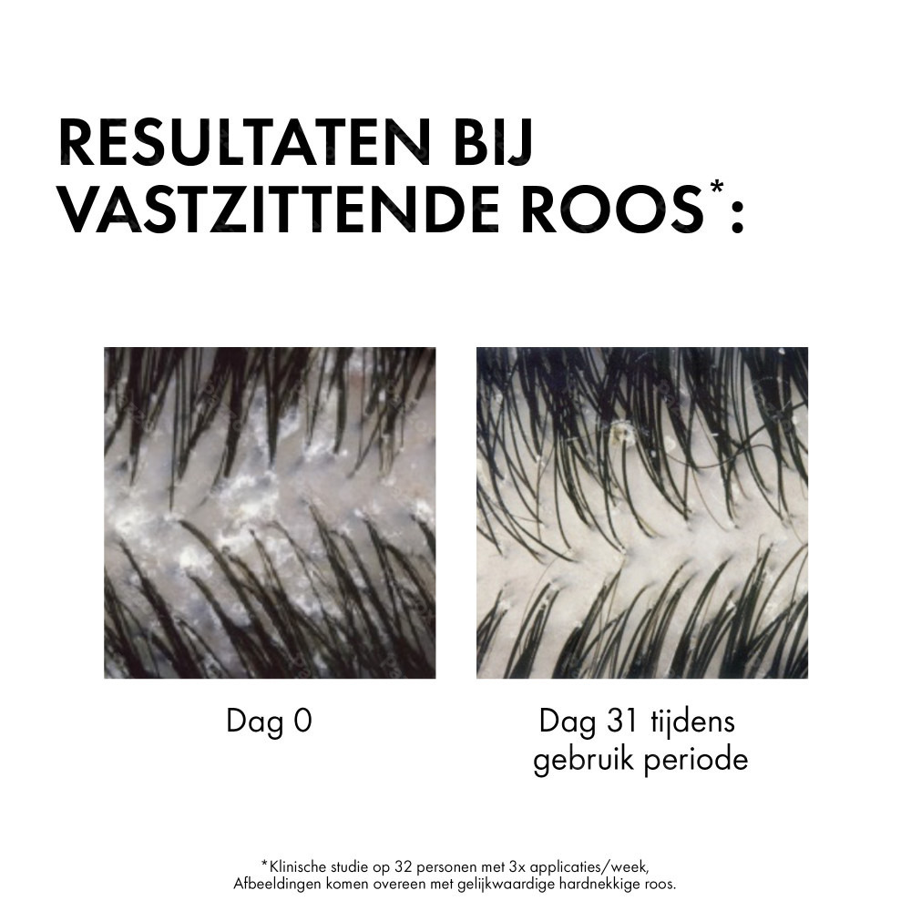 Vichy Dercos Anti-Roos DS Shampoo Navulling Droog Haar 390ml